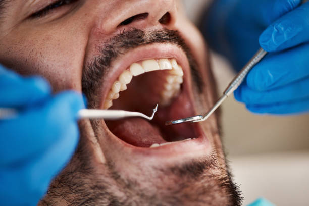 Best Emergency Treatment for Dental Infections or Abscesses in Matamoras, PA